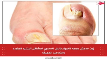 زيت مدهش يصفه الخبراء بالحل السحري لمشاكل البشرة العنيدة والتجاعيد العميقة